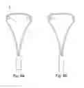 Fig. 09 - A Medical Device And Method For Facilitating Selection Of An Annuloplasty Implant