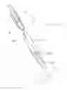 Fig. 07 - Devices and methods for reshaping blood vessels