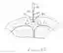 Fig. 11 - Devices and methods for reshaping blood vessels