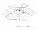 Fig. 12 - Devices and methods for reshaping blood vessels