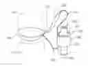 Fig. 01 - Tumid implant and pump