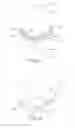 Fig. 03 - Tumid implant and pump