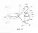 Fig. 04 - Tumid implant and pump