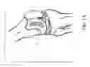 Fig. 02 - SYSTEM AND METHOD FOR THREE DIMENSIONAL PRINTED IMPLANTATION GUIDES