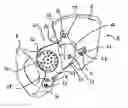Fig. 01 - Endoprosthesis for the partial replacement of the human pelvic bone