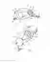 Fig. 02 - Endoprosthesis for the partial replacement of the human pelvic bone