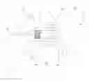 Fig. 01 - Modular spacer device for the treatment of prosthesis infections