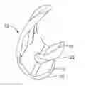 Fig. 01 - Systems and methods for providing a femoral component
