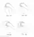 Fig. 17 - Systems and methods for providing a femoral component
