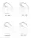 Fig. 18 - Systems and methods for providing a femoral component