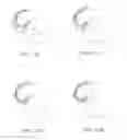 Fig. 20 - Systems and methods for providing a femoral component