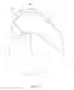 Fig. 24 - Systems and methods for providing a femoral component
