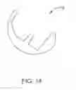 Fig. 25 - Systems and methods for providing a femoral component