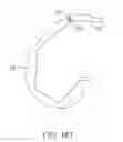 Fig. 43 - Systems and methods for providing a femoral component