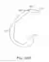 Fig. 46 - Systems and methods for providing a femoral component