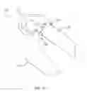 Fig. 64 - Systems and methods for providing a femoral component