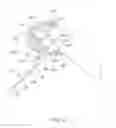 Fig. 65 - Systems and methods for providing a femoral component