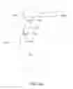Fig. 72 - Systems and methods for providing a femoral component