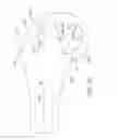 Fig. 76 - Systems and methods for providing a femoral component