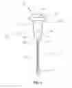 Fig. 02 - Apparatus and method for replacement of a metatarsophalangeal joint with interphalangeal fusion