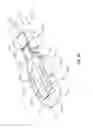 Fig. 24 - Pivotable interbody implant system