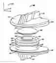 Fig. 01 - Artificial discs