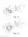Fig. 07 - Radially expandable spinal interbody device and implantation tool