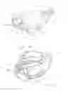 Fig. 14 - Radially expandable spinal interbody device and implantation tool