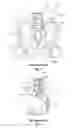 Fig. 03 - SUPPORT DEVICE AND METHOD OF USE