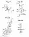 Fig. 07 - Methods and devices for delivering and affixing tissue scaffolds