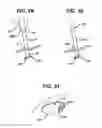 Fig. 11 - Methods and devices for delivering and affixing tissue scaffolds