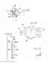 Fig. 04 - Separation of hip joint liner and socket elements