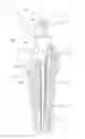 Fig. 01 - Methods and devices for a surgical hip replacement procedure