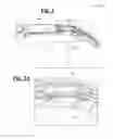Fig. 03 - Prosthetic hand system