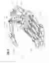 Fig. 07 - Prosthetic hand system