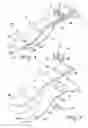 Fig. 02 - ARTIFICIAL FOOT