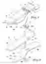 Fig. 04 - ARTIFICIAL FOOT