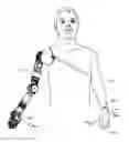 Fig. 01 - System for control of a prosthetic device