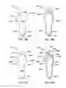 Fig. 07 - System for control of a prosthetic device