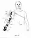 Fig. 23 - System for control of a prosthetic device