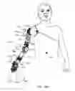 Fig. 24 - System for control of a prosthetic device