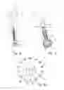 Fig. 05 - Implant for lower limb amputation