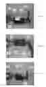 Fig. 05 - PAIN FREE SOCKET SYSTEM AND ASSOCIATED METHOD
