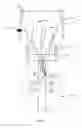 Fig. 15 - PAIN FREE SOCKET SYSTEM AND ASSOCIATED METHOD