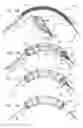 Fig. 02 - Minimization of stent-graft migration during implantation