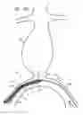 Fig. 07 - Minimization of stent-graft migration during implantation