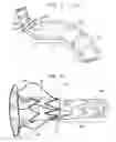 Fig. 24 - Minimization of stent-graft migration during implantation