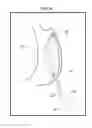 Fig. 11 - GASTRIC IMPLANT AND METHOD FOR USE OF SAME