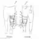 Fig. 04 - Systems and methods for increasing the effectiveness of a mechanical joint brace