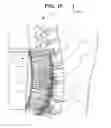 Fig. 08 - Orthopedic support with magnets